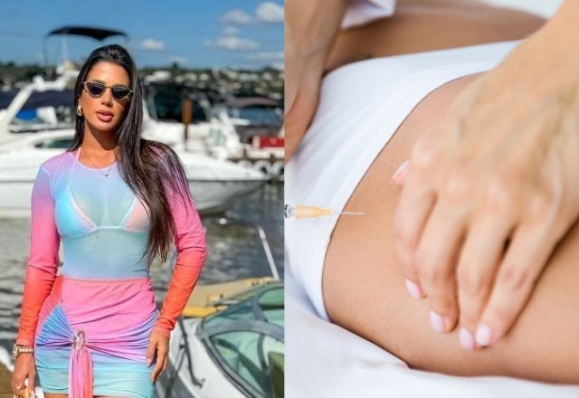 Imagem da noticia O que é PMMA? Quais são os riscos do uso em procedimentos estéticos? Entenda