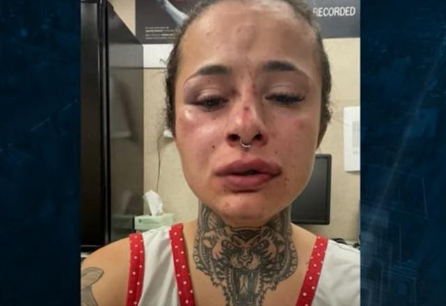 Imagem da noticia Tatuadora brasileira é agredida pelo namorado nos EUA
