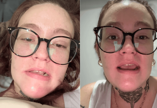 Imagem da noticia Jovem com a 'pior dor do mundo' reconsidera eutanásia e é diagnosticada com nova doença