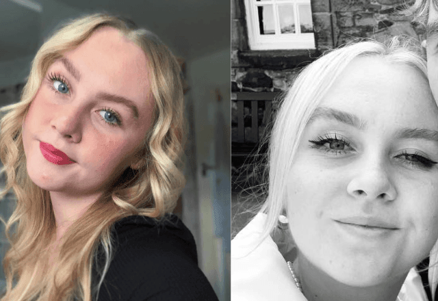 Imagem da noticia "Tenho que colar meus olhos abertos": jovem de 22 anos é diagnosticada com blefaroespasmo; entenda