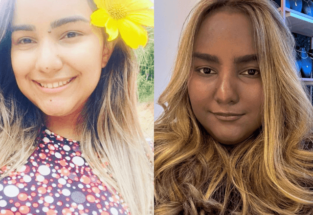 Imagem da noticia Cor da pele de jovem muda após diagnóstico de tumor raro no tórax; entenda