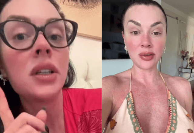 Imagem da noticia Juju Salimeni diz que confundiu dengue com alergia após notar manchas no corpo; como identificar?