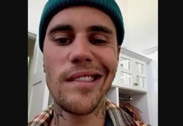 Imagem da noticia Síndrome de Ramsay Hunt: Entenda doença que causou paralisia em Justin Bieber