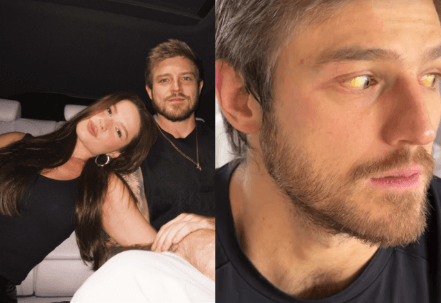 Imagem da noticia Kaique Cerveny, noivo de Juliette, é diagnosticado com hepatite A; como doença é transmitida?