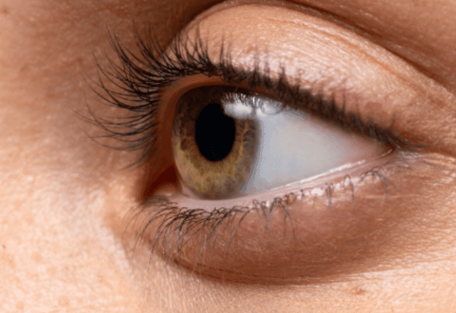 Imagem da noticia Mais de 200 pacientes têm complicações oculares após mutirões no Brasil; 45 perderam a visão