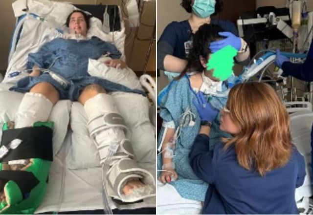 Imagem da noticia Brasileira fica paralisada após contrair bactéria rara nos EUA; família pede ajuda