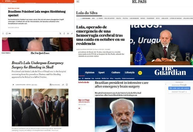 Imagem da noticia Imprensa internacional repercute cirurgia às pressas de Lula