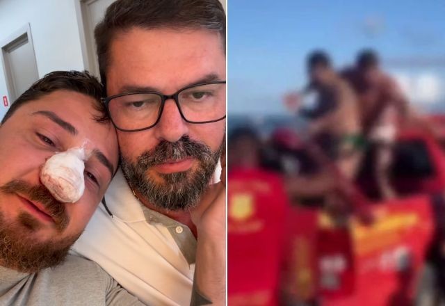 Imagem da noticia Turista agredido em Porto de Galinhas passa por cirurgia para corrigir fratura no rosto