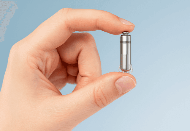 Imagem da noticia Marcapasso sem fio: o chip no coração que reduz cortes e acelera a recuperação