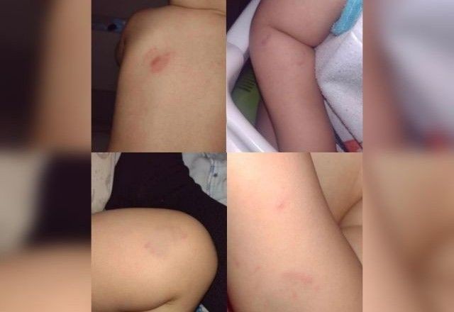 Imagem da noticia Mãe denuncia creche por supostos maus-tratos ao filho de 1 ano no Entorno do DF