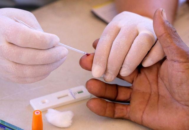 Imagem da noticia Farmácias começam a aplicar testes para dengue, HIV, sífilis e hepatite