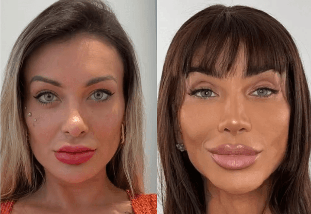 Imagem da noticia Andressa Urach e Maya Massafera mudam cor dos olhos com cirurgia proibida no Brasil; saiba riscos