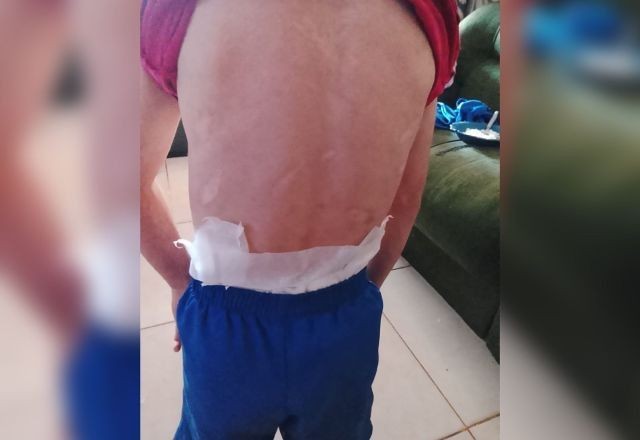 Imagem da noticia Polícia investiga denúncia de maus-tratos contra criança de 8 anos no DF; madrasta é principal suspeita