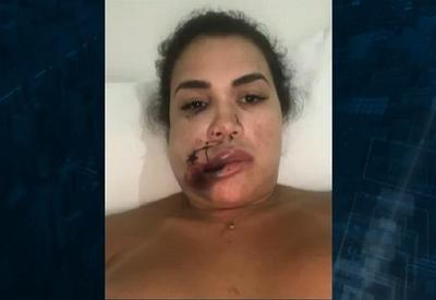 Caso de corretora agredida poderá ser julgado como tentativa de homicídio Caso de corretora agredida poderá ser julgado como tentativa de homicídio