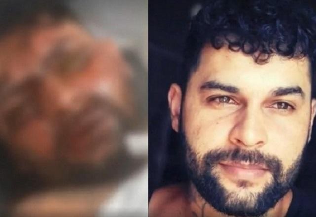 Imagem da noticia Mulher joga soda cáustica no rosto do ex, que fica cego