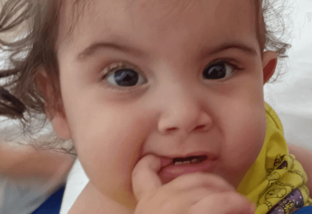 Imagem da noticia Morre Kiraz, uma das gêmeas siamesas de São Paulo separadas em cirurgia em Goiás