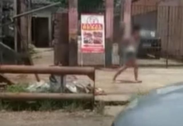 Imagem da noticia Mulher é esfaqueada pelo ex e corre para pedir socorro