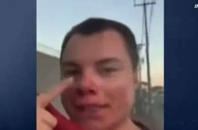 Influenciador é agredido em festa universitária e fica em coma no interior de SP Influenciador é agredido em festa universitária e fica em coma no interior de SP