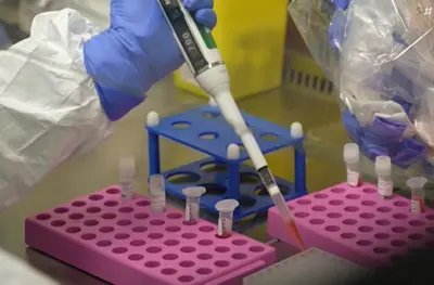 Tailândia e Malásia reforçam triagem em aeroportos após casos do vírus Nipah na Índia Tailândia e Malásia reforçam triagem em aeroportos após casos do vírus Nipah na Índia