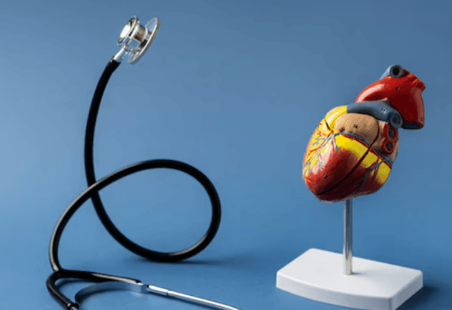 Imagem da noticia Dia do Colesterol: o que você precisa saber sobre condição silenciosa que pode causar infarto e AVC?