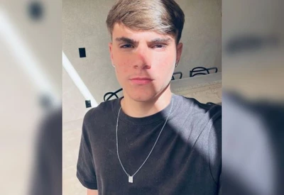 Adolescente agredido pelo ex-piloto Pedro Turra morre em hospital do DF Adolescente agredido pelo ex-piloto Pedro Turra morre em hospital do DF