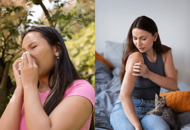 Imagem da noticia Dia Mundial da Alergia: Como saber se sou alérgico? Entenda