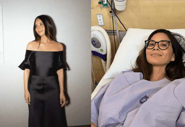 Imagem da noticia Atriz de 'X-Men' diz que tem tricotilomania; entenda distúrbio que faz pessoa arrancar o cabelo
