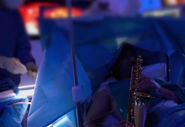 Imagem da noticia Paciente toca saxofone durante cirurgia no cérebro