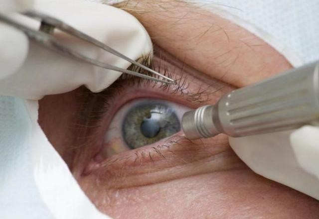 Imagem da noticia Partículas de coronavírus são encontradas em olhos de pacientes