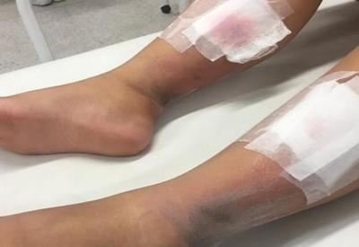 MG: criança com síndrome de down é atingida por bomba após jogo no Mineirão MG: criança com síndrome de down é atingida por bomba após jogo no Mineirão