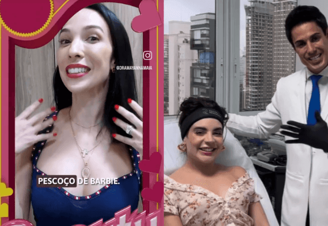 Imagem da noticia 'Botox da Barbie': quais são os riscos do procedimento que viralizou na internet?