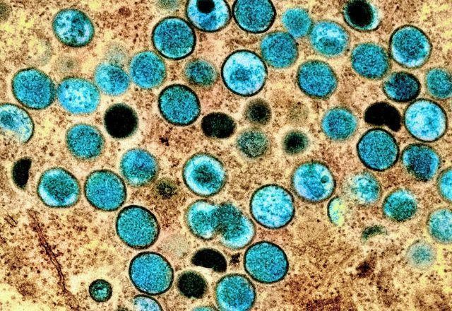 Imagem da noticia Brasil registra primeiro caso de varíola dos macacos em animal