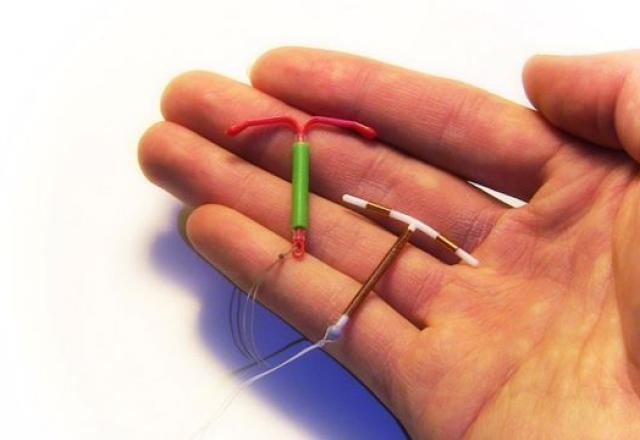 Imagem da noticia Planos terão que explicar autorização de marido para inserção de DIU