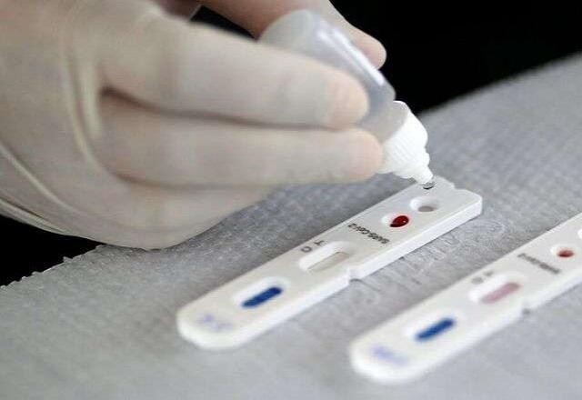 Imagem da noticia Covid-19: Brasil registra mais 1.023 casos e 66 mortes em 24 horas