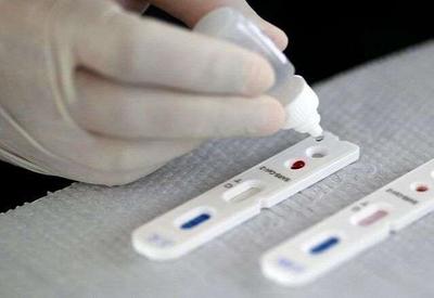 Covid-19: Brasil registra mais 1.023 casos e 66 mortes em 24 horas Covid-19: Brasil registra mais 1.023 casos e 66 mortes em 24 horas