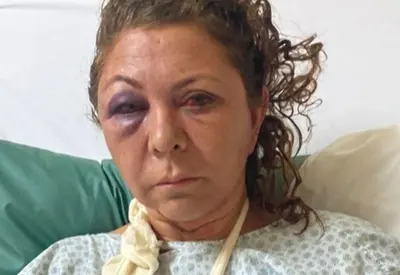 Recepcionista é agredida por hóspede dentro de hotel em Curitiba Recepcionista é agredida por hóspede dentro de hotel em Curitiba