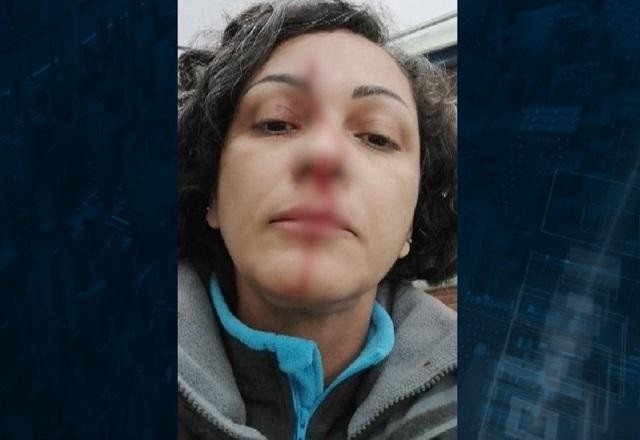 Imagem da noticia Funcionária de escola estadual denuncia agressão de mãe de aluno