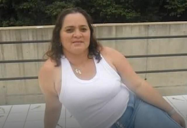 Imagem da noticia Servidora pública morre após passar por duas cirurgias plásticas em MG