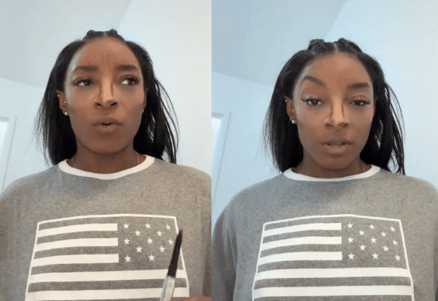 Imagem da noticia Simone Biles compartilha experiência negativa com 'baby botox'; saiba o que é