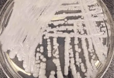 Confirmado caso de superfungo 'Candida auris' no Rio Grande do Norte Confirmado caso de superfungo 'Candida auris' no Rio Grande do Norte