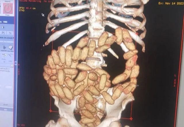 Imagem da noticia Seis nigerianos são presos com cocaína no estômago em aeroporto de SP