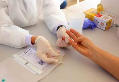 São Paulo é o estado que mais testa para Covid-19 no Brasil, diz Doria São Paulo é o estado que mais testa para Covid-19 no Brasil, diz Doria