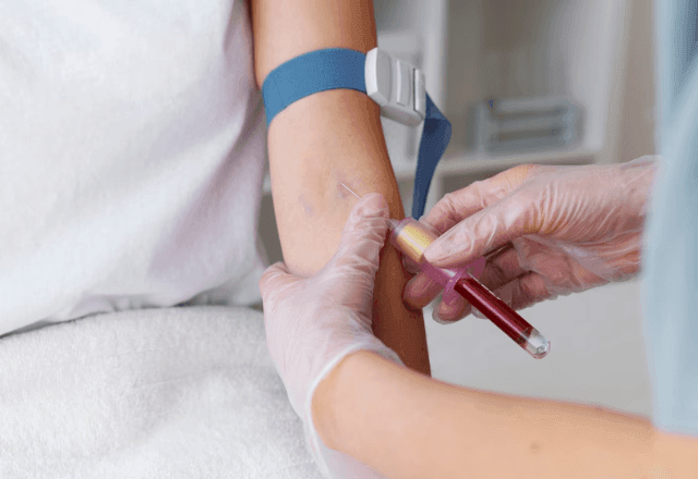 Imagem da noticia EUA aprovam exame de sangue que detecta câncer colorretal; entenda