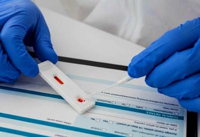 Covid-19: quase 23% das pessoas testadas receberam diagnóstico positivo Covid-19: quase 23% das pessoas testadas receberam diagnóstico positivo