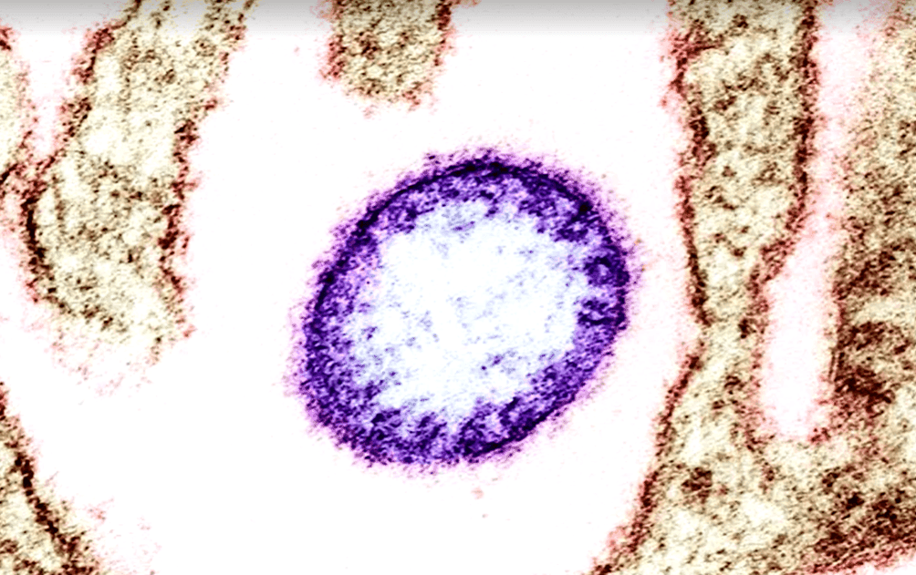 O que sabemos sobre o vírus Nipah, que causa novo surto na Ásia O que sabemos sobre o vírus Nipah, que causa novo surto na Ásia