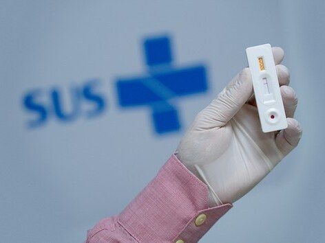 Imagem da noticia SUS incorpora teste de HPV para detecção da doença em mulheres