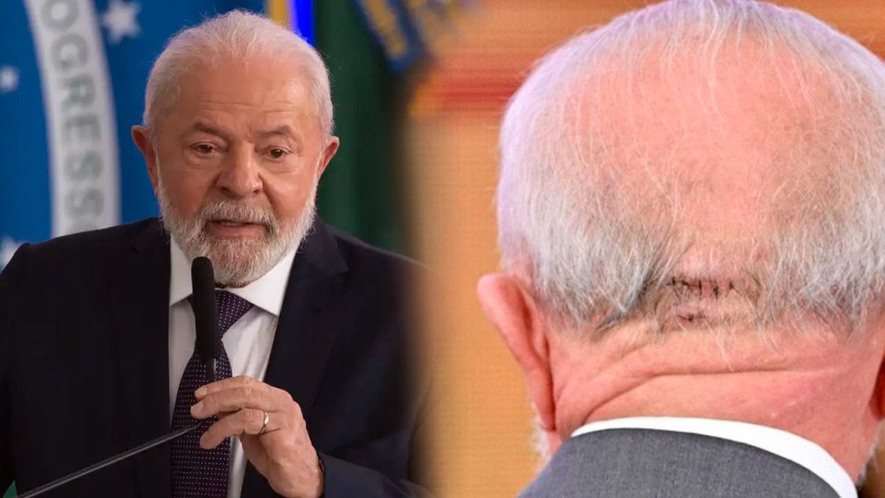 Imagem da noticia Poder Expresso: Após cirurgia, PT teme que Lula fique fora da disputa de 2026