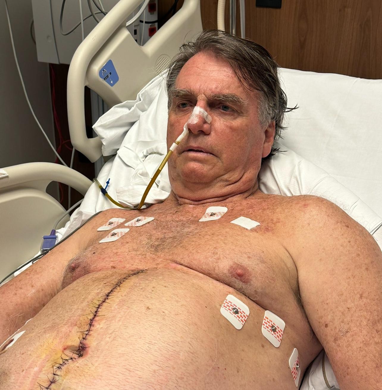 Imagem da noticia Internado na UTI, Bolsonaro tem boa evolução clínica e agradece orações