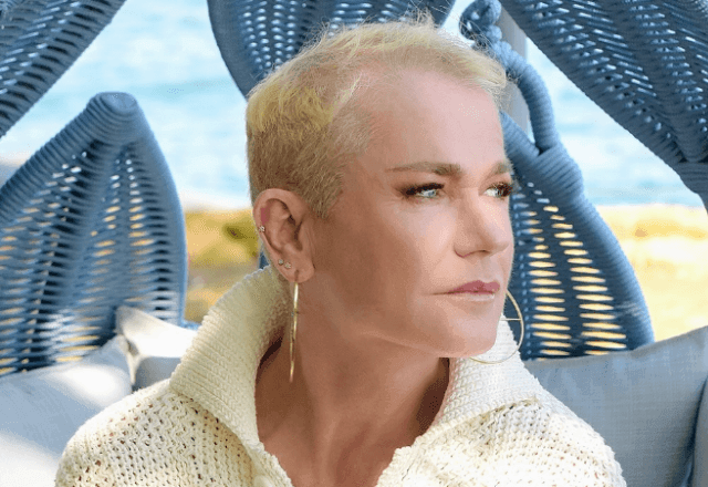 Imagem da noticia Alopecia androgenética: entenda condição que afeta Xuxa