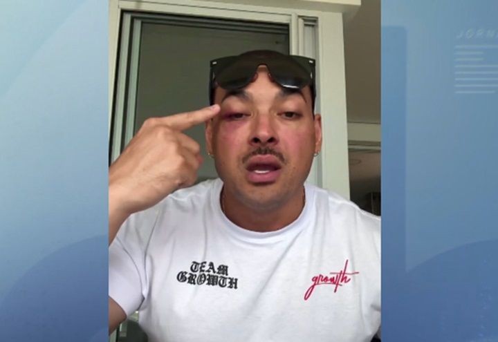 Imagem da noticia Deputado Felipe Franco se envolve em confusão com seguranças durante show de Chris Brown